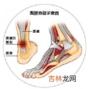 飞行员跟腱断裂15例治疗体会