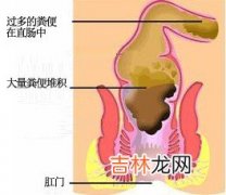 摆脱冬日暗沉5招恢复迷人脸色