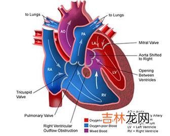 冬季肺心病患者的家庭监护