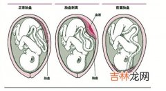 胎盘上餐桌食用须经产妇同意