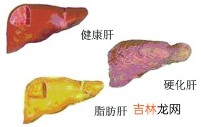 据调查企业家五成脂肪肝92点3有健康问题