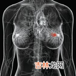 有科学家称病毒导致乳腺癌