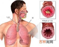 冬季哮喘病人应尽量避免接触过敏源