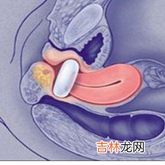 多蹲少坐有利脏器锻炼