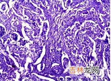 童年少食水果成年易患肿瘤等病
