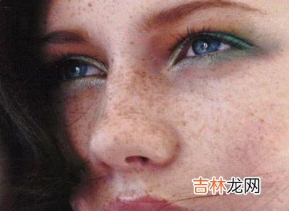 告诉你色斑形成的原因