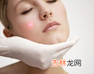 激光美容术的适应症