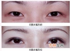 女人必知效果最佳美白的偏方