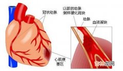 急性心梗袭９龄童