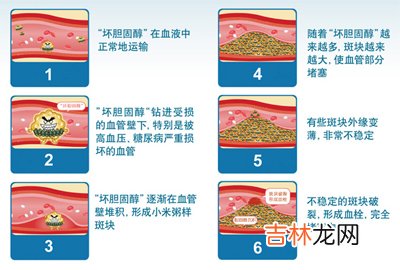 眼皮长疣查查胆固醇