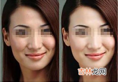 12种美白护肤方法 不白都不行
