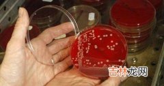 美国：发现“超级病菌”ＭＲＳＡ