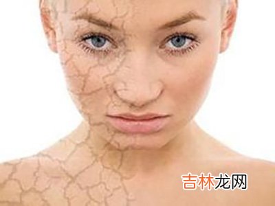 干性肌肤 急需保湿急救