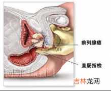 调查显示：婚后不生育男性因素占一半以上