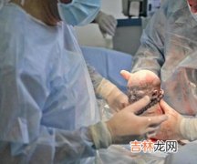 研究显示：剖腹产造成产妇死亡风险大