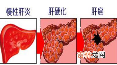 陈奕迅父亲病情恶化成早期肝癌 接受儿子捐肝