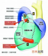 5岁女孩脏器全长反 医生反向执刀手术成功