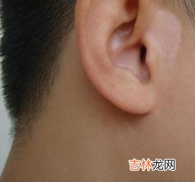 小女孩吃药10年治疗“白癜风” 发现原来被误诊