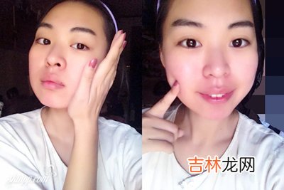 皮肤干燥问题多多 你如何解决