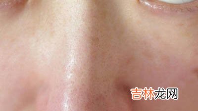 去黑头收毛孔如何一次搞定