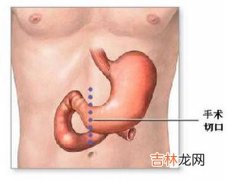 度假村一餐饭毒倒30教师 食物引急性肠炎