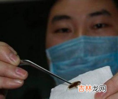 男子睡梦中被蟑螂钻入耳朵 鲜血渗出耳道