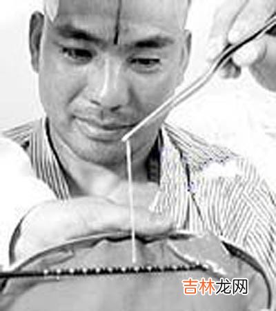 1.4米绦虫“吃瘦”壮汉 医院进行“杀虫”治疗
