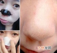 扫除黑头瞬间就让你拥有娇嫩美肌