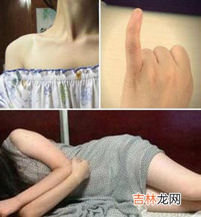 身体哪些部位一晒就黑