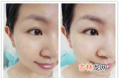 不同缺水肌肤 如何针对性补水