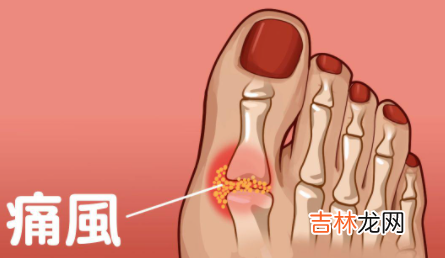 痛风喝茶水有没有影响