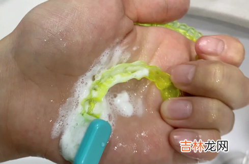 牙套咖喱染色多久可以退掉