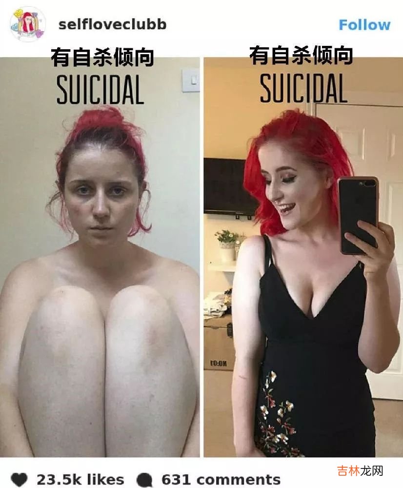 她们都因抑郁症而死,我希望你开心地活下去