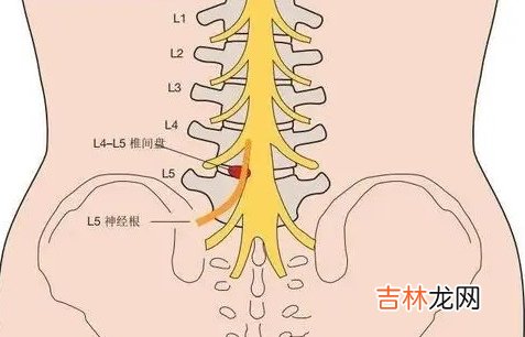脊康杏林 骶骨疼痛的原因有哪些？
