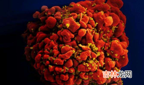 hiv两次检查假阳性吓死我了