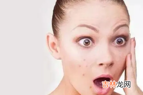 下巴长痘痘是哪里的问题