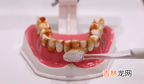 牙齿不痛不痒突然掉了一块有影响吗