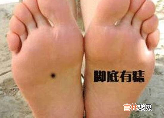 女人脚底心有痣命好吗，命很好，福禄双全