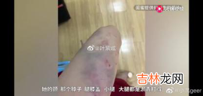 女教师遭家暴跳楼身亡:被逼到什么地步,才会以死解脱?