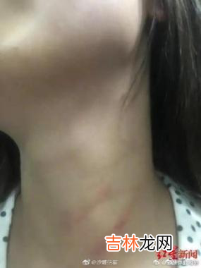 女教师遭家暴跳楼身亡:被逼到什么地步,才会以死解脱?