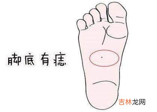 女人脚底长痣代表什么，代表有权有势