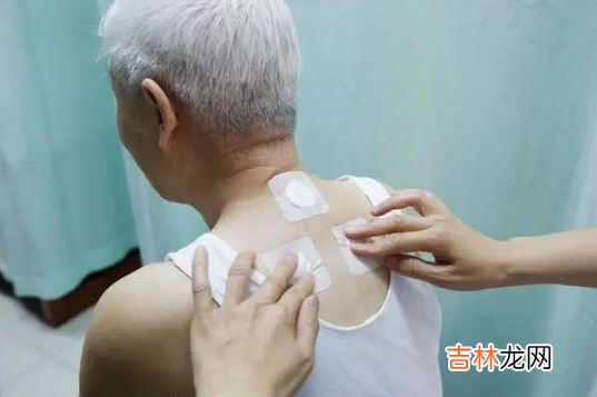 2022三伏贴的贴敷五次时间