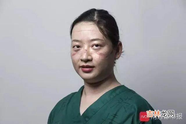痛哭、失眠、崩溃：疫情过后，他们是最痛苦的人