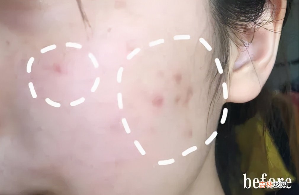 喷雾杀虫剂家用 喷雾杀虫剂测评
