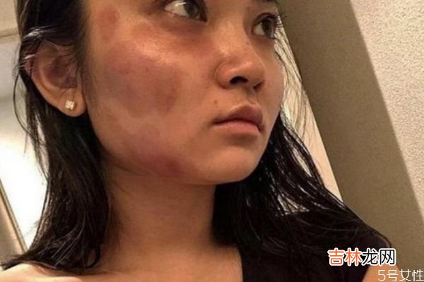 家暴可以容忍吗? 应该怎么看待家暴