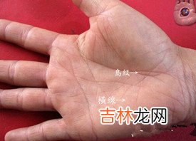 紫薇排盘算命_不育妇女掌相、眼白有痣、掌色鲜红的详解