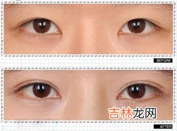 算命先生说我生女孩_割眼皮改运,鼻子发青,狐狸喉的人命运