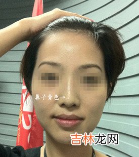 算命先生说我生女孩_割眼皮改运,鼻子发青,狐狸喉的人命运