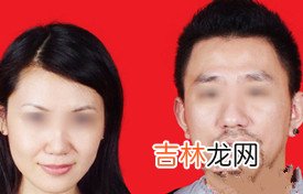 测名字打分算命_迁移宫有痣，印堂被遮及额女性分析