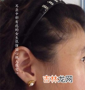 算命的说我犯婚煞是什么意思_额头、火星丘黑痣、生命线岛纹及聪明痣详解